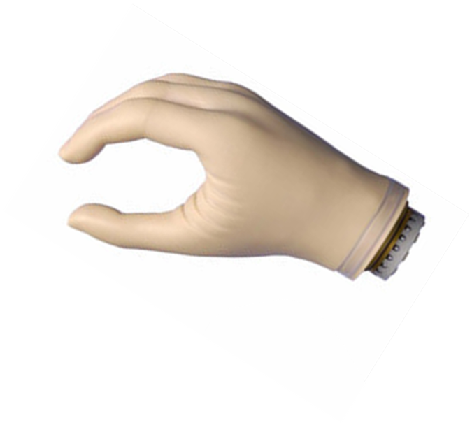 上肢假肢價格如何選擇合適的上肢假肢(圖1) 上肢假肢價格如何選擇合適的上肢假肢(圖1)