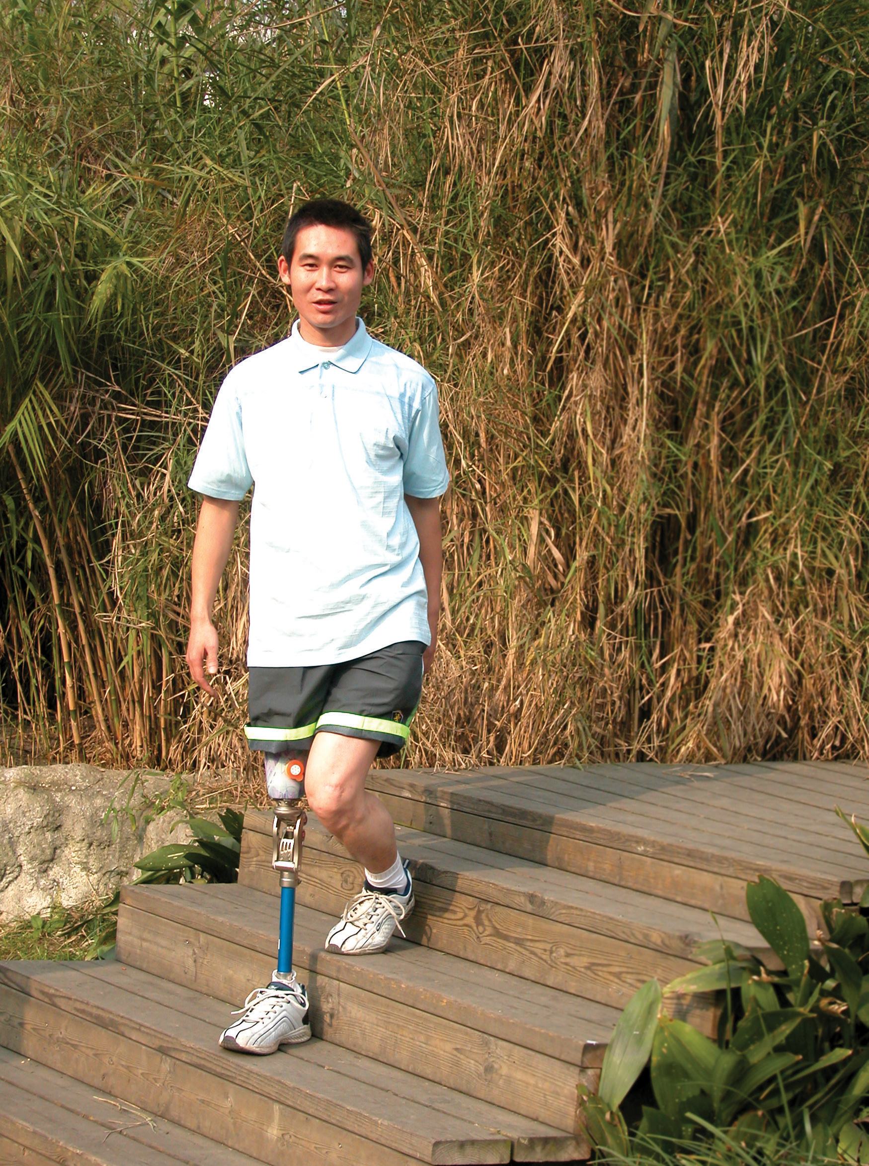 假肢價格便宜的可以選擇嗎？