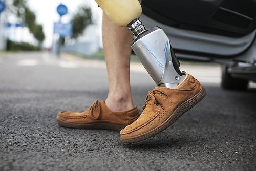 一具普通的假肢價(jià)格在多少范圍內(nèi)較合適?(圖2) 假肢價(jià)格